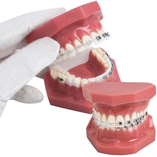 Resin Zähne Dental-Modell Demonstration Modell Zähne KFO-Studie Teach mit dem Metall und Keramik-Support, Rot 7.5 * 6.2 * 6.5cm von ATJOGWIN