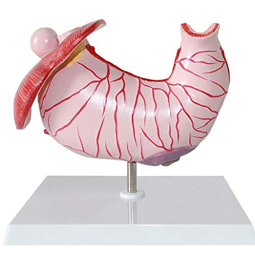 AYCDL Anatomisches Magenmodell, Gastritis-Modell, Magenläsions-Modell, Magenpathologie, Geschwür-Modell, menschliches Organ, anatomisches Anatomie-Modell für Schule, Bildung von AYCDL