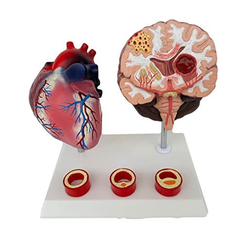 AYCDL Menschliches Herzmodell, Cardio-Pathologie des Blockadeprozesses, Modell, Lehre, Wissenschaft, Lehrressourcen, Herz anatomisch von AYCDL