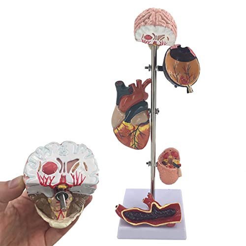 Diabetes-Organmodell, anatomisches menschliches Bluthochdruckmodell, menschliches Organ, Gehirn, Herz und Blutgefäß, Diabetes, Aktivität, Demonstration, Lehrhilfen, C von AYCDL