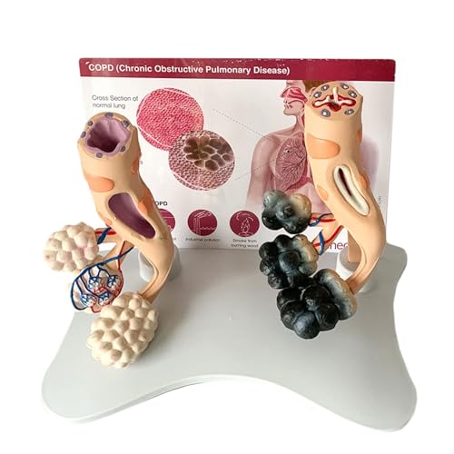 BALENFAY Menschliche Lungengesundheit Alveolarmodus Menschliches Organ Anatomisches Modell Eingeweide Alveolen Vergrößern Modell Pädagogische Trainingshilfe von BALENFAY