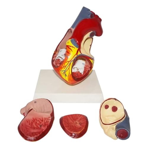 BALENFAY Modell des menschlichen Herzens – Anatomisches Modell menschlicher Organe, Trainingsmodell for das Herz – 4 Teile for Lehrvorführungen, Laborausrüstung von BALENFAY