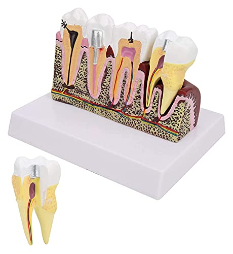 Anatomiemodell für den naturwissenschaftlichen Unt Zahnzähne Modell Demonstration Base for Dental Research General Anatomy Research (Größe: 6.5x5.1x4.5in) von BROHN