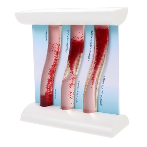 COSMEVIVI Dynamic Blood Vessel Model Anatomisches Lehrmodell Zur Simulation Von Blutgefäßen Für Medizinische Ausbildung Und Unterricht COSMEVIVI Dynamic Blood Vessel Model Anatomisches Lehrmodell Zur Simulation Von Blutgefäßen Für Medizinische Ausbildung Und Unterricht von COSMEVIVI