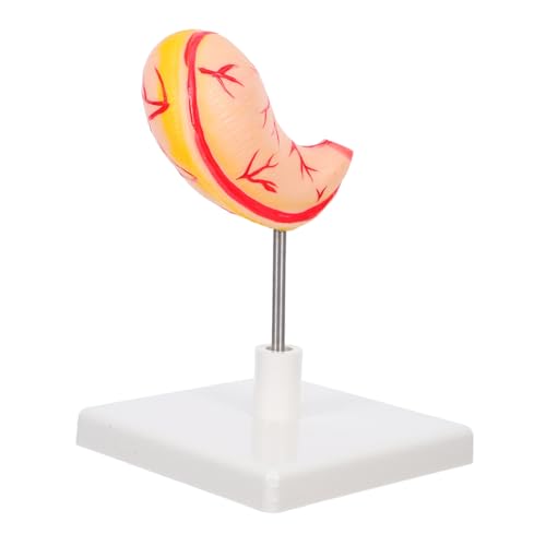 DIKACA Anatomisches Magenmodell Lehrmodell Stomach Training Model für Medizinische Ausbildung Klinische Schulung Einfach zu Montieren und Realistische Darstellung Menschlicher DIKACA Anatomisches Magenmodell Lehrmodell Stomach Training Model für Medizinische Ausbildung Klinische Schulung Einfach zu Montieren und Realistische Darstellung Menschlicher von DIKACA