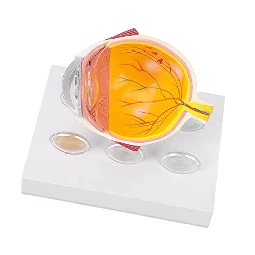 Augenanatomiemodell, Zeigt Realistische Details der Sehnerven, Menschliches Augapfelmodell für Glaukom von Denash