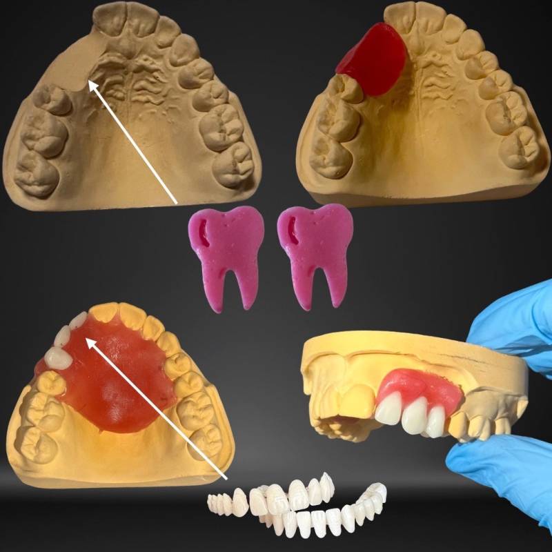 Craft Your Model, Learn Model, Dental Fix Kit, Diy Denture Show Model Prothesis Model von Etsy - DentalMental