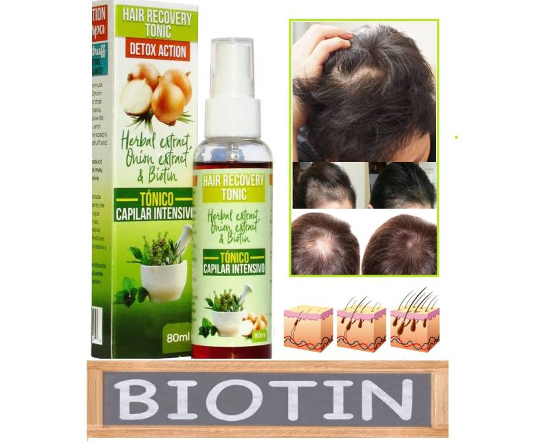 2 Unzen Haar-Wachstum-Lotion-Behandlungsspray Für Verlust Oder Dünnes Haar Biotin Minoxidil Ginger Escobillo von Etsy - MayaCollector