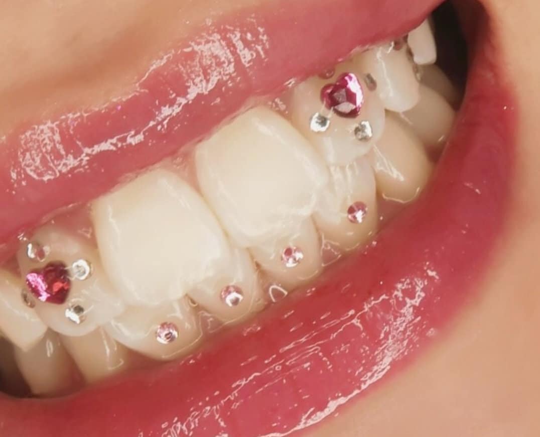 Tru Radiance Love Freestyles Tooth Gems von Etsy - TruRadiances