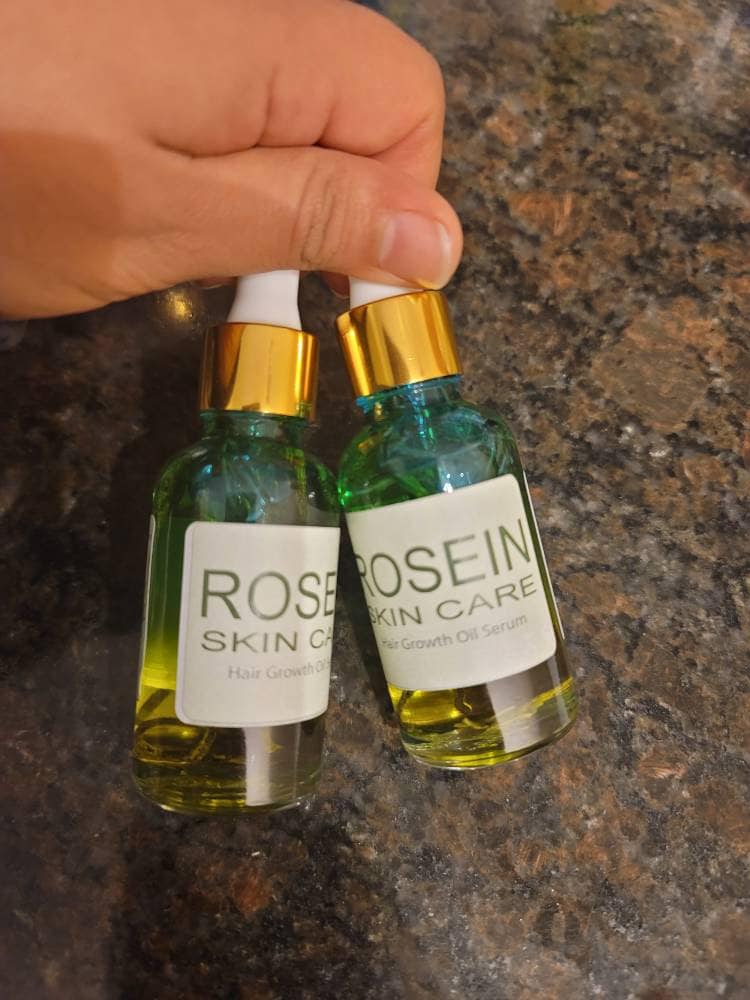 Rosmarin Haar-Wachstum-Öl-Serum | Bartwuchsöl Serum Kopfhautöl Rosmarin-Haarwuchsöl von Etsy - roseinskincares