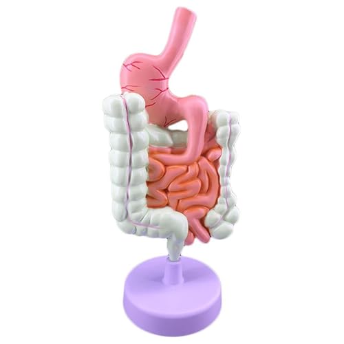 Magenanatomie, Dickdarm, Blinddarm, Rektum, Zwölffingerdarm, Struktur der inneren Organe des Menschen, Magen-Darm-Läsion, Dickdarm-Läsion, Anatomiemodell einer Darmerkrankung, Modell des von FYYYSLKX