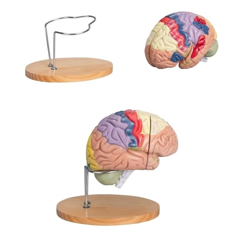 Zerebrovaskuläres Modell Neurologie Anatomisches Modell Des Menschlichen Gehirns Lehrmodell Lebensgroßes Gehirnmodell Neun Regionen 2-fache Vergrößerung 4-teiliges Am Gehirn Befestigtes von FYYYSLKX