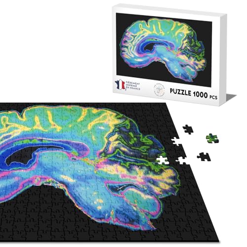 Klassische Puzzle 1000 Teile Gehirnscanner Medizinisches Röntgenbild Klassische Puzzle 1000 Teile Gehirnscanner Medizinisches Röntgenbild von Fabulous