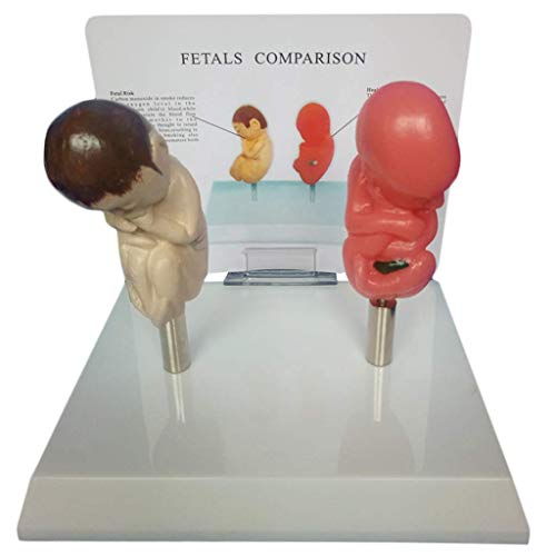 Fötus-Modellierung Von Fötus Und Normalem Fötus-Vergleichsmodell Modell PVC Modelle Der Menschlichen Anatomie Für Studienanzeigen, Die Medizinisches Modell von Generic