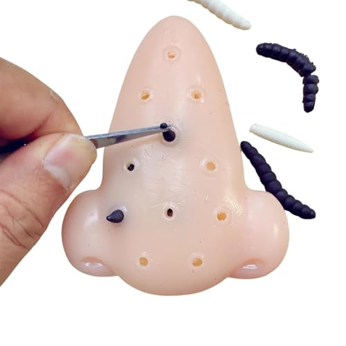 pimple popper toys acn popping spielzeug,stressabbau spielzeug,acnes spielzeug,acnes quetschspielzeug,pickelsammelspielzeug,pickelsammelspielzeug,pimple sammelspielzeug,pimple spielzeug, von Generic