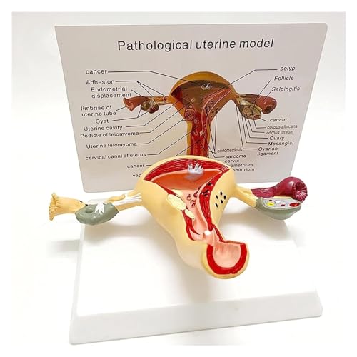 Anatomischen Anatomiemodell, Eierstock, pathologisches Modell, Gebärmutter, anatomisches Modell mit abnehmbaren Organen for pädagogisches Werkzeug, Organmodell Modell von HELGN