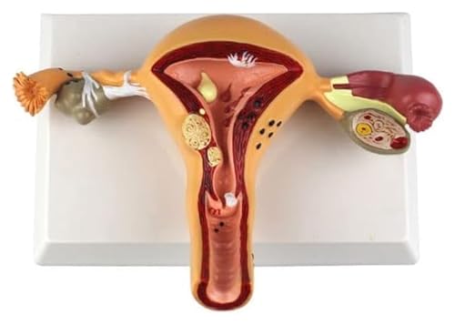 Anatomischen Anatomiemodell des menschlichen Körpers, weibliches Fortpflanzungsmodell, Uterusmodell, Lehrmodell for gynäkologische Eierstockpathologie, Organe Modell von HELGN