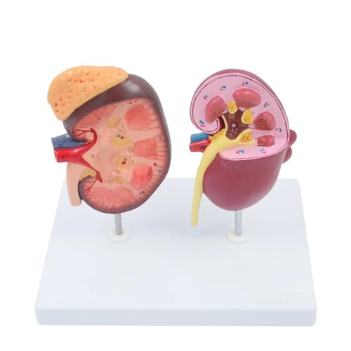 1 Stück normales und erkranktes Nierenmodell, Harnsystem, Nierenanatomiemodell, Lehrmittel for medizinische Wissenschaft von Huhpa