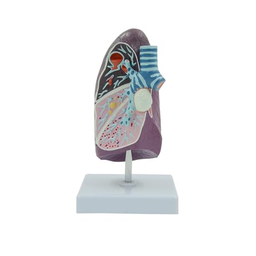 1PC Human Pathological Lung Model Simulation Smoker Lung Internal Organ Specimens Thoracic Surgery Respiratory Department Teaching von Huhpa