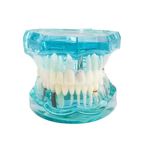 1pc Dental Studie Zahn Transparent Erwachsene Pathologische Zähne Modell von Huhpa