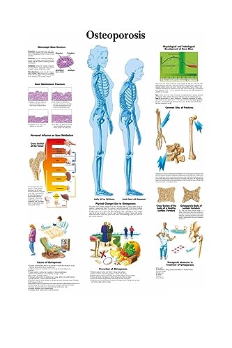 1pc Karte Seide Malerei Wand Bilder for Medizinische Bildung Büro Wohnkultur Menschlichen Anatomie Muskeln System Körper Kunst Poster leinwand(1,13X18cm No Frame) von Huhpa