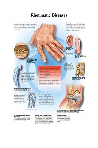 1pc Karte Seide Malerei Wand Bilder for Medizinische Bildung Büro Wohnkultur Menschlichen Anatomie Muskeln System Körper Kunst Poster leinwand(2,20X25cm No Frame) von Huhpa