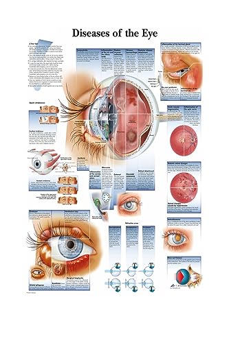 1pc Karte Seide Malerei Wand Bilder for Medizinische Bildung Büro Wohnkultur Menschlichen Anatomie Muskeln System Körper Kunst Poster leinwand(6,13X18cm No Frame) von Huhpa