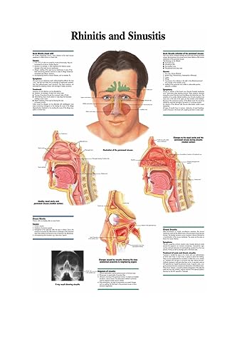 1pc Karte Seide Malerei Wand Bilder for Medizinische Bildung Büro Wohnkultur Menschlichen Anatomie Muskeln System Körper Kunst Poster leinwand(7,13X18cm No Frame) von Huhpa