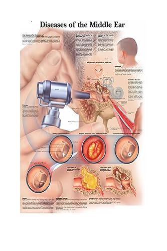 1pc Karte Seide Malerei Wand Bilder for Medizinische Bildung Büro Wohnkultur Menschlichen Anatomie Muskeln System Körper Kunst Poster leinwand(8,30X40cm No Frame) von Huhpa