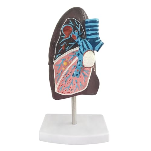 1pc Menschliche Lunge Anatomisches Modell Raucher Tuberkulose Pathologische Lunge Modell Medizinische Forschung Schule Lehrmittel von Huhpa