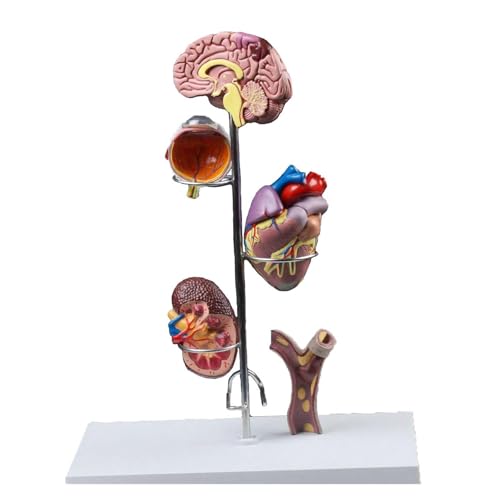 1pc Menschliches Hypertensive Modell Zerebrovaskuläre Medizin Allgemeine Anatomische Chirurgie Lehrmittel Bildung von Huhpa