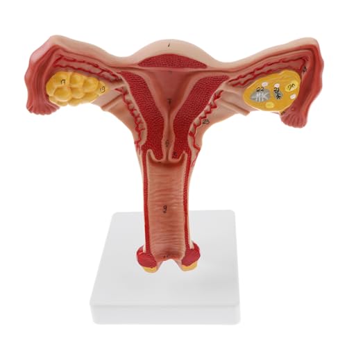 1pc Menschliches Weibliches Uterus Eierstock Eileiter Modell Medizinische Wissenschaft Lehrmittel von Huhpa