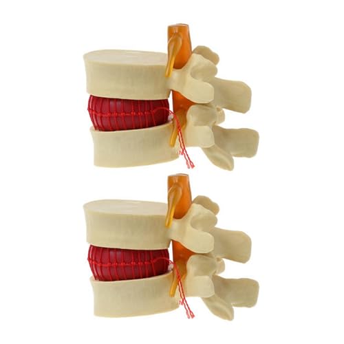 2 stücke Lendenwirbel Modell Anatomische Wirbelsäule Bandscheibenvorfall Anatomie Lehrmittel Lendenwirbel Modell von Huhpa