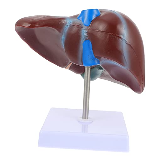 IMIKEYA Medizinisches Menschliches Lebermodell mit Stabilem Sockel Anatomisches Lehrmodell für Schule und Ausbildung Detaillierte Realistische Darstellung der Leberstruktur Einfach zu IMIKEYA Medizinisches Menschliches Lebermodell mit Stabilem Sockel Anatomisches Lehrmodell für Schule und Ausbildung Detaillierte Realistische Darstellung der Leberstruktur Einfach zu von IMIKEYA