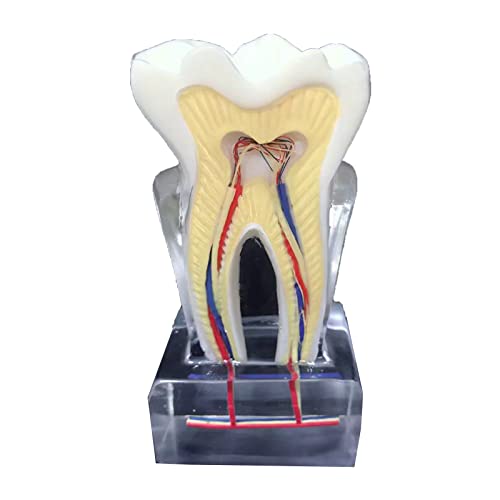 6 x Dentalprofilmodell – Studienmodell Zahndisplay Modell – Medizinische Wissenschaft Zähne Anatomisches Modell – Kristallklare Lehrinstrumente Lehrmittel – für Arzt-Patienten-Kommunikation von LKYLVEE