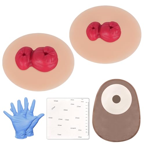 MedEduQuest Sticky Loop Ileostomie-Simulatoren, Stoma-Trainingsmodell-Set, Praxismodelle für die Stomapflege in mehreren Hauttönen für die medizinische Ausbildung und Patientenaufklärung – Leicht MedEduQuest Sticky Loop Ileostomie-Simulatoren, Stoma-Trainingsmodell-Set, Praxismodelle für die Stomapflege in mehreren Hauttönen für die medizinische Ausbildung und Patientenaufklärung – Leicht von MedEduQuest