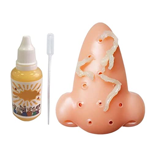 NASSMOSSE Pimple Popper Spielzeug, Pickle Pop Toy Squeeze Acne Toys Nase Pickle Poping Toy Stress Relief Neue Spielzeug mit 30 ml Additive Lösung von NASSMOSSE