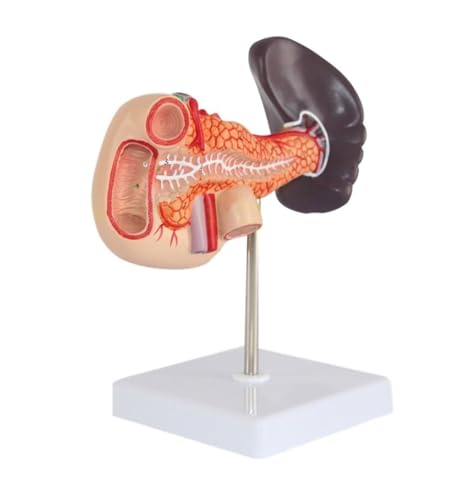 Anatomie Modell Menschliches Milz- Und Bauchspeicheldrüsenmodell, Anatomisches Menschliches Bauchspeicheldrüsen-Zwölffingerdarm-Milzmodell Als Studienanzeigewerkzeug Anatomie Eines Falls von REIFOR