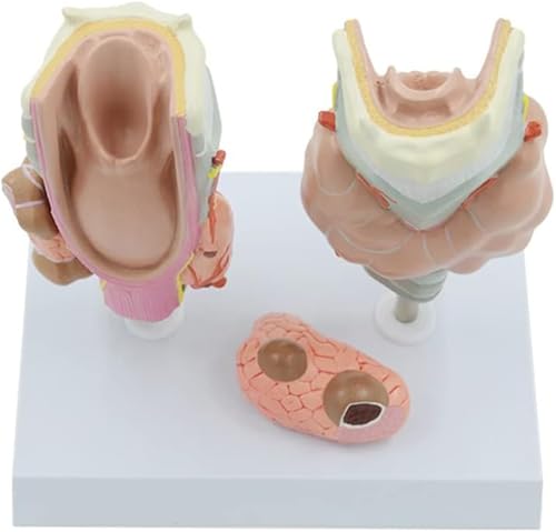 Medizinische Lehrmittel, Pathologiemodell einer Schilddrüsen-Hals-Tumorzyste, Replika von Kehlkopf- und Schilddrüsenmodellen, Modell des Schilddrüsenerkrankungssystems, Lernressourcen for Arztpraxen u von RMJEZTQD