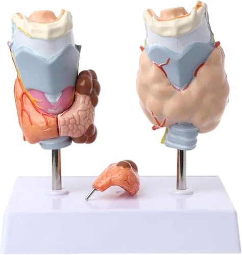 Modell der menschlichen Schilddrüsenpathologie, Modell einer Schilddrüsen-Hals-Tumorzyste, normal und krank mit Pathologien, anatomisches Modell, medizinische Lehrhilfen, zur Demonstration von Kropf, von RMJEZTQD