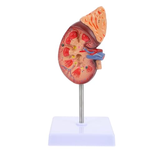 SKISUNO Nierenmodell Biologie Demonstrationsmodell Krankheitslungenmodell Modelle Biologieunterricht Modell der anatomischen Organe menschlicher Körper Requisiten Probe Säule PVC von SKISUNO