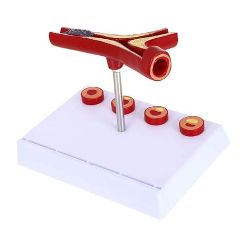 Sosoport Human Anatomical Model Herz Kreislauf PVC Modell mit Thrombose und Darstellung Vergrößertes Medizinisches Lehrmodell für Studium und Langlebig und Detailreich Sosoport Human Anatomical Model Herz Kreislauf PVC Modell mit Thrombose und Darstellung Vergrößertes Medizinisches Lehrmodell für Studium und Langlebig und Detailreich von Sosoport