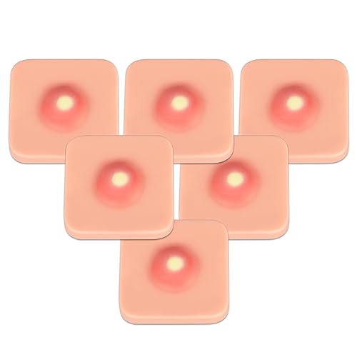 Ultrassist Abszess I&D Inzision und Drainage Pad (6er-Pack), Sebaceous Zyste Entfernung Trainer, Naht Praxis Haut Pad für medizinische Ausbildung von Ultrassist