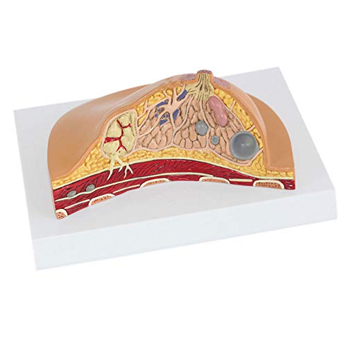 VDLLQYN, Anatomisches Modell der Brustläsion, anatomisches Modell der Bruststruktur, natürlich groß, verwendet for medizinische Forschung, Anatomie-Lehrdisplay ，Anatomie-Modelle von VDLLQYN