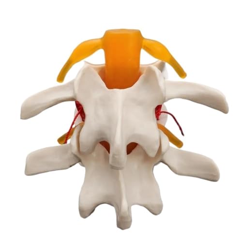 Demonstrationsmodell der menschlichen Lendenhernien-Pathologie, 12 x 12 x 10 cm, lebensgroßes Modell der Lendenwirbelsäulenanatomie des Menschen, 1 Stück von YJQHODY