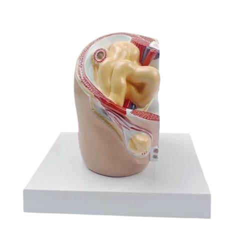 1 Stück Anatomiemodelle menschlicher Körperteil 18 x 15 x 15 cm, schräges Leistenbruch-pathologisches Hautmodell, Anatomie-menschliches Körpermodell von YXYFA