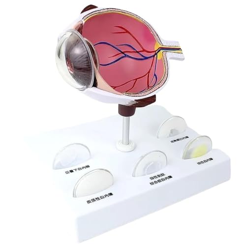 1 Stück menschliches Katarakt-Vergrößerungs-Augen-internes Anatomie-Modell, 16,3 x 12,7 x 17 cm Augapfel-Anatomie-Modell for den Unterricht von YXYFA